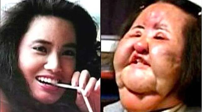 Deretan artis gagal operasi plastik. (Foto: Instagram)