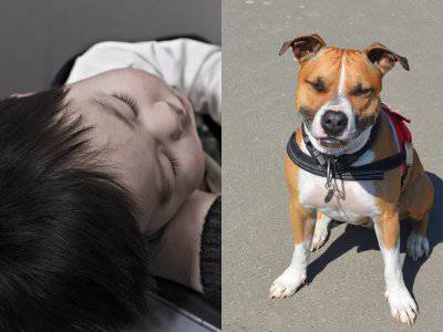 Seorang Bocah Di Medan Digigit Anjing Pitbull Miliknya