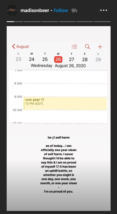 オリビア カルポ 子宮内膜症を患っていると告白 症状に苦しむ心境を吐露
