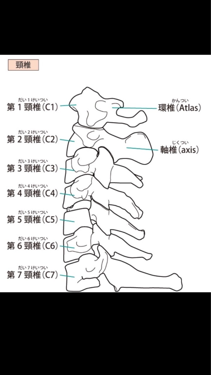 頸椎椎間板ヘルニア