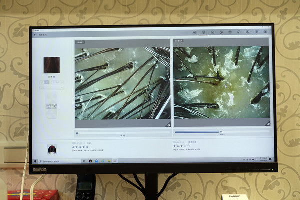 台北頭皮護理，台北頭皮養護spa-WT Methode美絲得，源自韓國的台北專業頭皮養護，給頭皮極致享受的大直頭皮護理中心