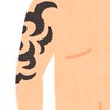 タトゥー、刺青除去
