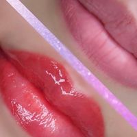 美容整形相談室👩‍🎓男女OK. ステマ無・リアルな優良情報交換し合いましょう