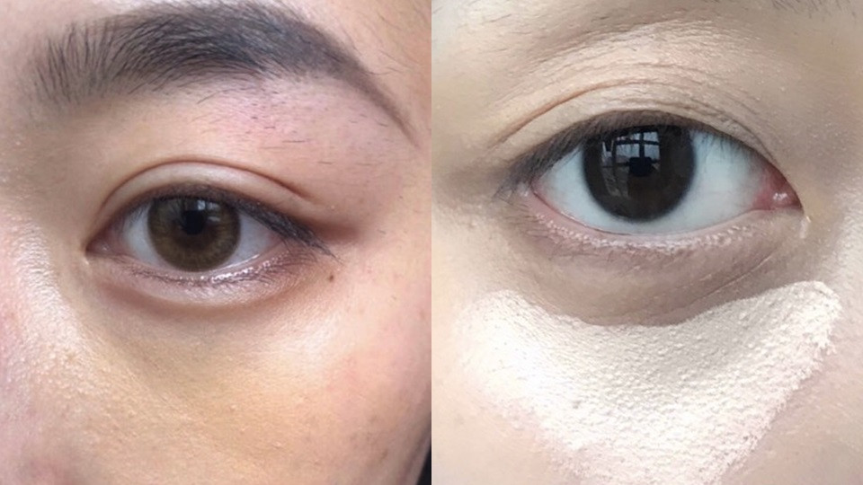 黑眼圈跟淚溝怎麼分？