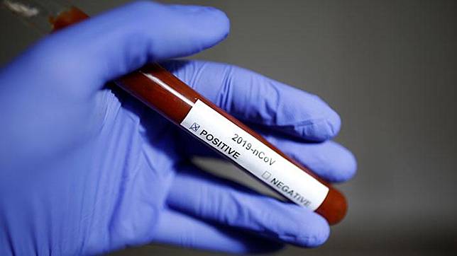 Dutch Test Blood Donations For Unseen Coronavirus Spread