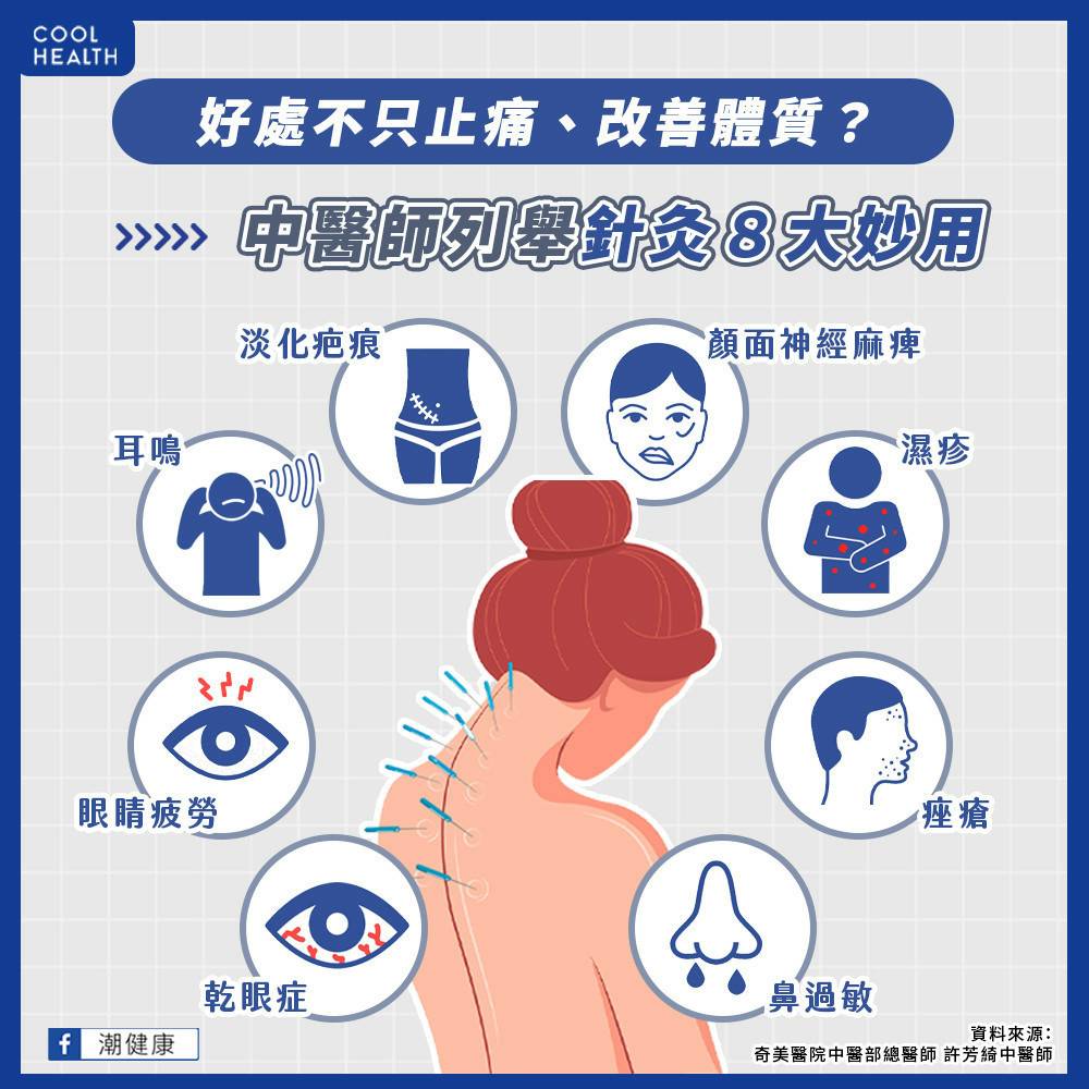 針灸好處不只止痛？ 中醫師列「8大妙用」：有望改善濕疹、鼻過敏問題 | 潮健康 | LINE TODAY