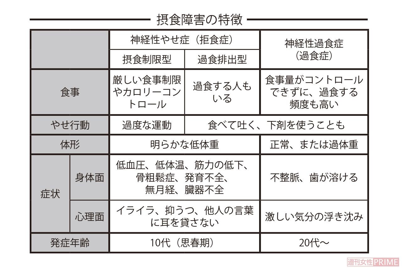 医者が語る やりすぎるダイエット の危険性 週刊女性prime