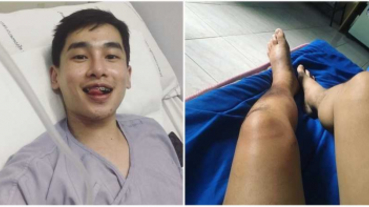 24歲男星皮膚癌病逝！ 生前樂觀發文：我失去了腳...粉絲淚崩