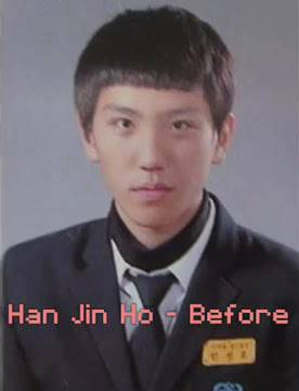 5 Foto Transformasi Sebelum Oplas Para Selebgram Dunia Part II, Lihat Awkarin!