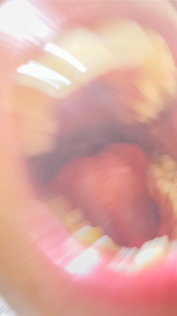 大晦日系奥歯