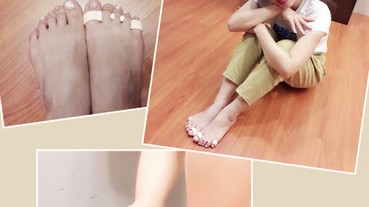 ［產品］美腿導正分趾套～走路直挺不歪斜，輕鬆擁有女神美腿！