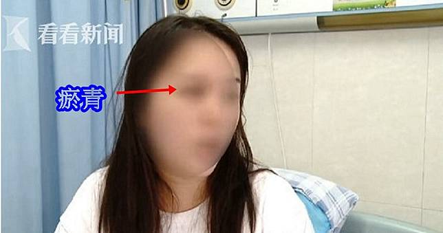 正妹拒敬酒！餐廳股東暴怒「打斷鼻樑」　拿刀追砍嗆：弄死妳