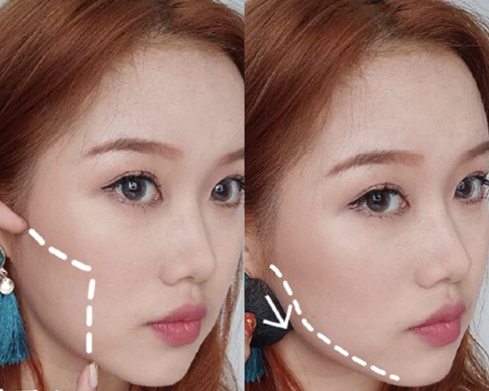 下頷角突出修容位置：顴骨下方、下顎線