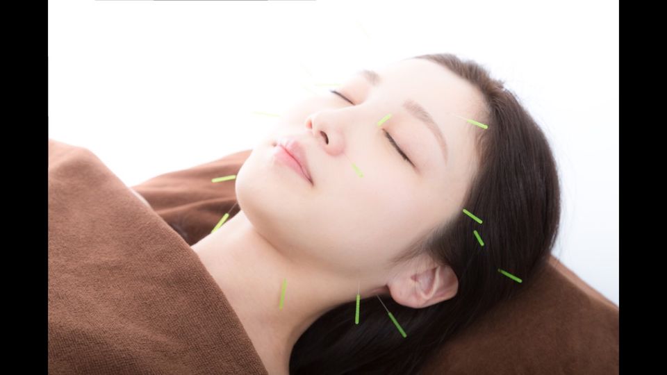 美顔鍼 小顔調整