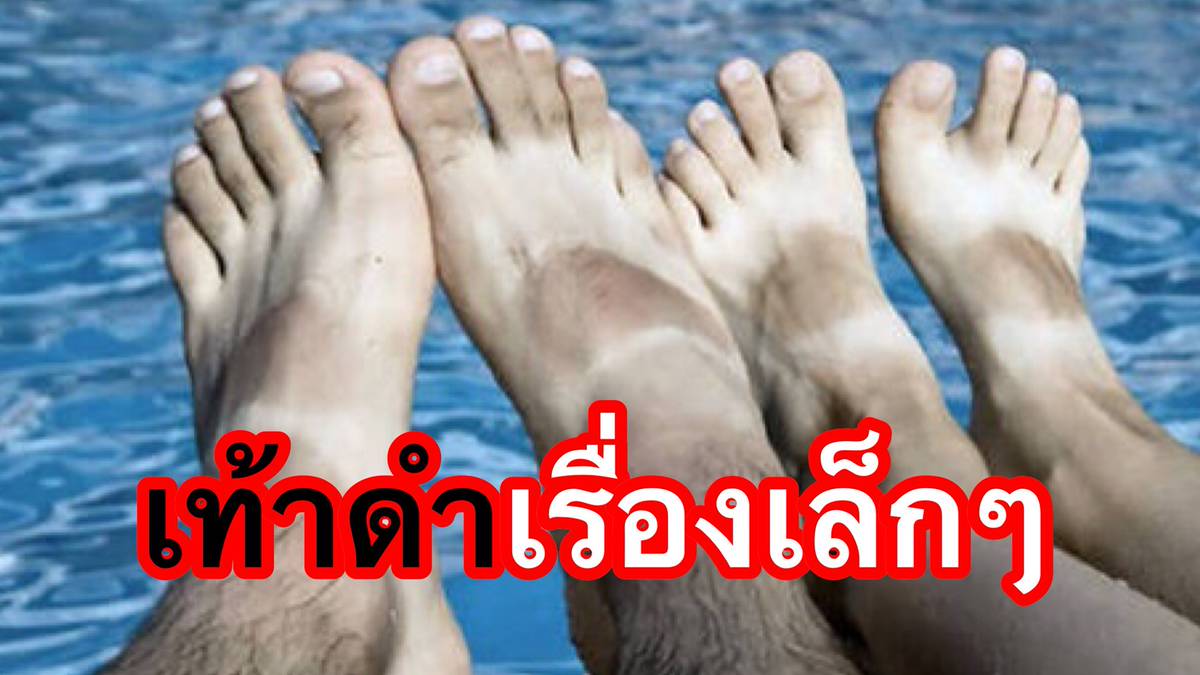 เท้าดำแก้ได้ด้วย 9 สูตรบำรุงเท้าขาวแบบธรรมชาติ | Tvpoolonline.Com | Line  Today