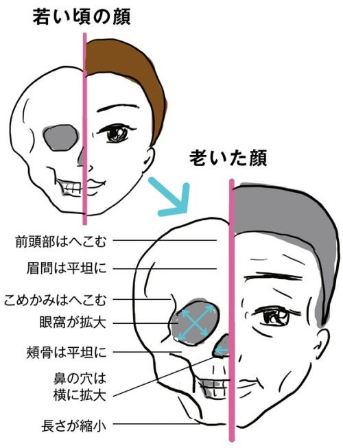 顔面の 骨やせ でたるむってほんと