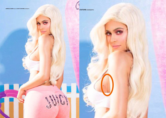 Kylie Jenner隆乳