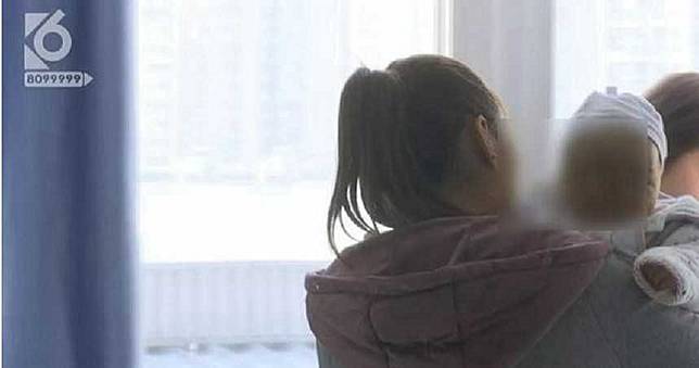 3月女嬰遭「老鼠狂啃臉」鼻子沒了　醫：因為有奶味