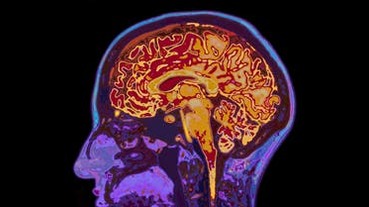 人腦的超能力！科學家找到腦產生意識的線索