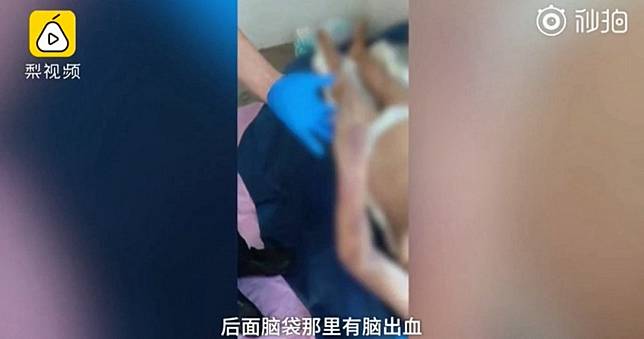 母住院2天遭3醫師「綁手腳打到死」　陸醫院冷回：賠100萬夠嗎