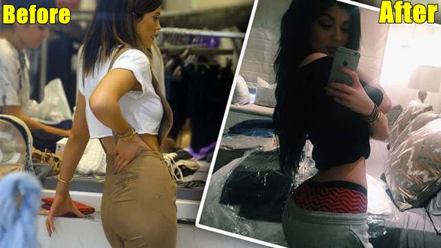 8 Foto Kardashian Bersaudara Sebelum & Sesudah Oplas, Pangling Banget