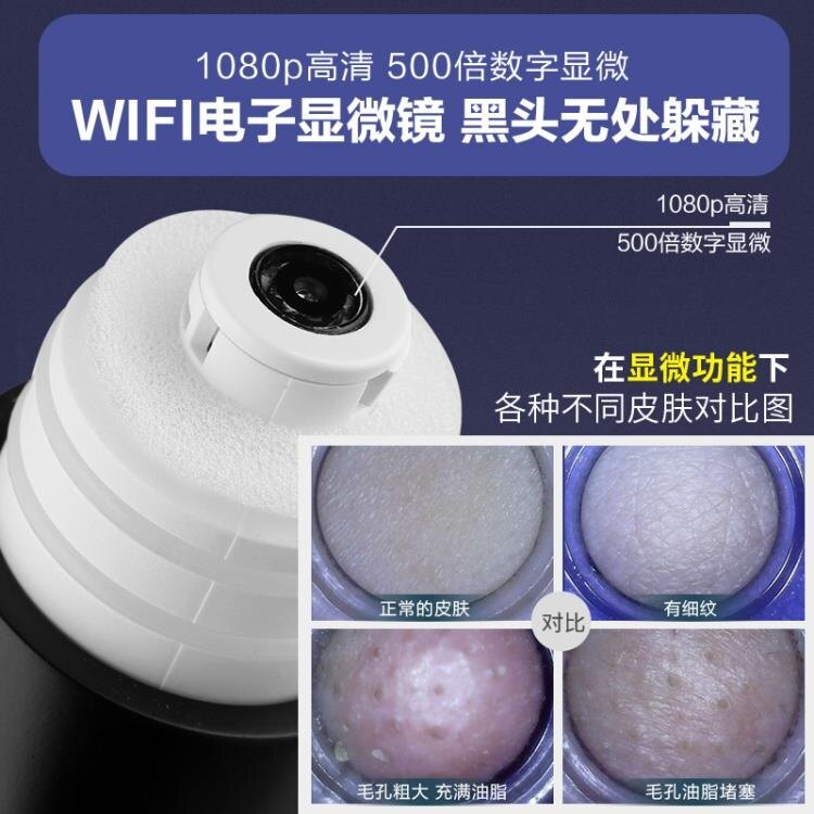 黑頭清潔儀 吸黑頭神器小氣泡可視化去黑頭儀去毛孔粉刺螨蟲清潔面儀吸出器 【精選好物！】【上新免運包郵】【下單立減】【下單抵扣】【下單多重優惠】