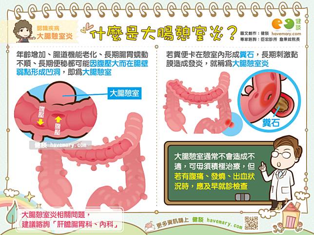 憩室 炎 原因 大腸