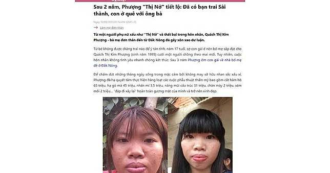 迷唇姐砸43萬整形！爽嫁富二代下場超慘　曲折人生成網紅
