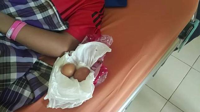Temuan Penting Dokter Soal Fenomena Remaja Bertelur Ayam