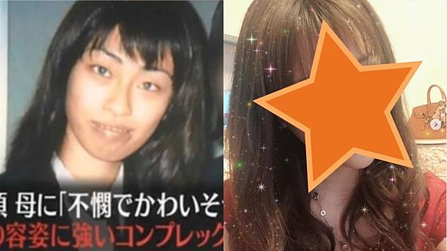 椿朋海自18歲起整形高達300次。圖／翻攝自椿朋海IG