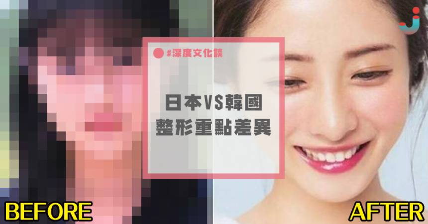 淺談 日本v S 韓國 整形技術差異 其實日本人才是整形大師 日本集合 Line Today