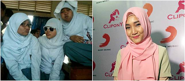 12 Foto Transformasi Wajah Artis Dulu vs. Kini, Beda Banget! 