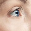 กลุ่มโรคกระจกตาโป่ง (Keratoconus)