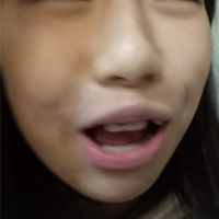 社交牛逼症