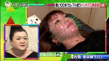 只有富有的美女光顧的針灸美容