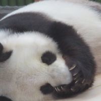 醜形恐怖症