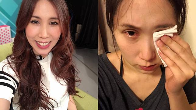 余苑綺直腸癌復發。圖／翻攝自余苑綺 Chichi臉書