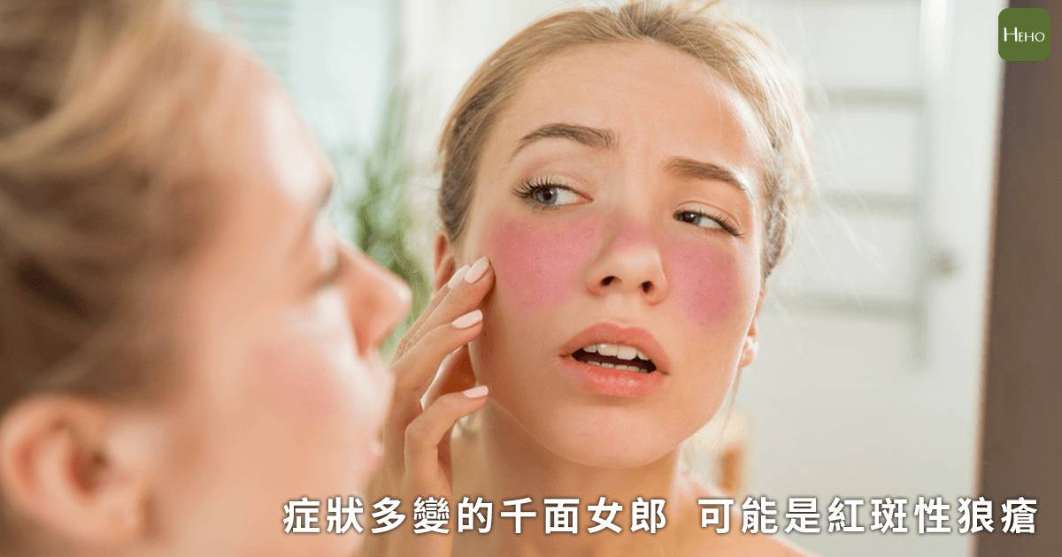 莫名發燒 掉髮 會喘你是紅斑性狼瘡的患者嗎 Heho健康 Line Today