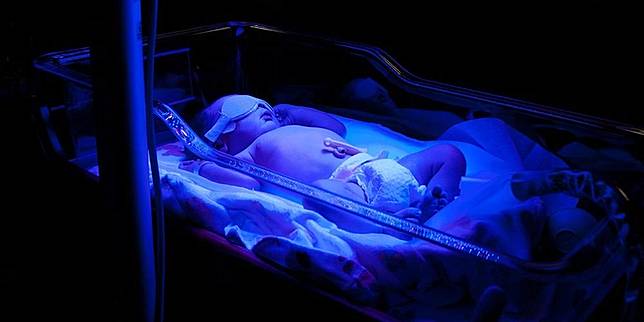 Ini Kadar Bilirubin Normal Pada Bayi Baru Lahir Sehatq Line Today