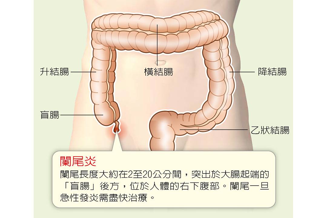 右下腹部痛