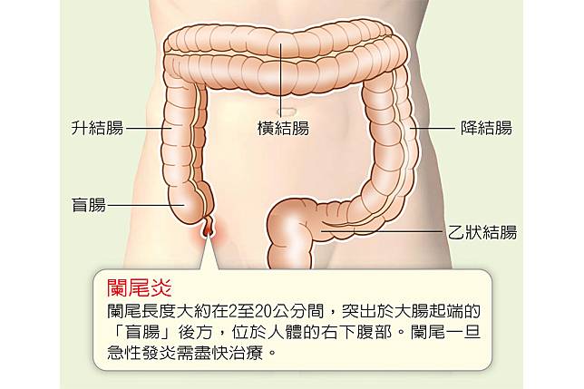 右下腹部痛