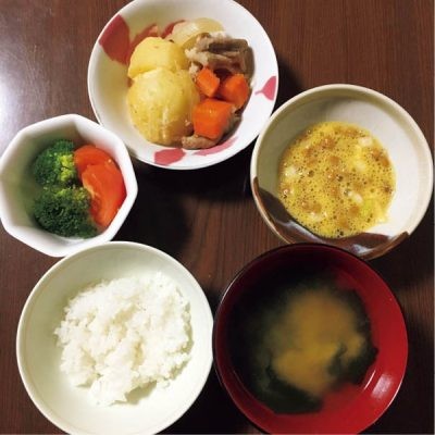 仕事柄 便意を我慢しがちで慢性的便秘のaさん 便秘外来の受診で重度の症状はどこまで変わる