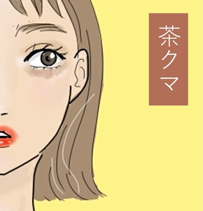 クマの隠し方 が タイプ別にわかる コンシーラーの選び方や赤リップで隠す方法も Mine