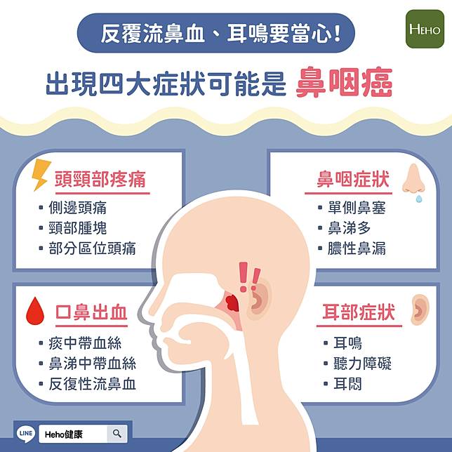 反覆流鼻血、耳鳴要當心！出現四大症狀可能是鼻咽癌 Heho健康 LINE TODAY