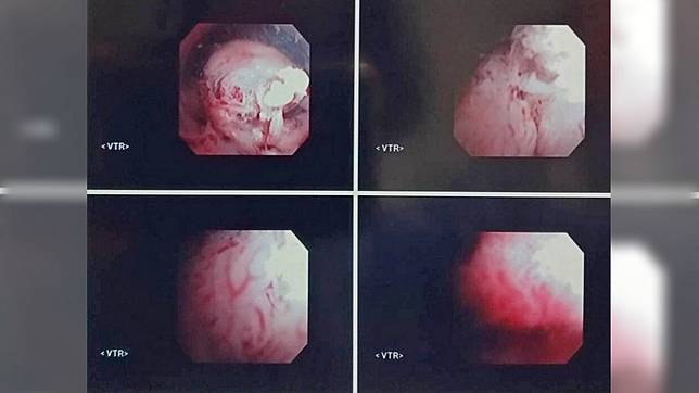 圖／台北慈濟醫院提供