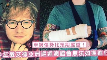 車禍傷勢比預期嚴重！Ed Sheeran亞洲巡迴演唱會將無法如期進行，台北至香港站演唱會都確定會延期！