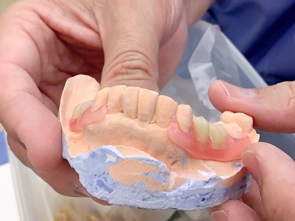 「台中植牙」太平牙醫推薦，全家牙齒守護最佳首選-台中市北屯區星星牙醫診所直擊分享