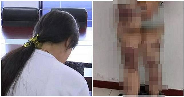 母嫌「30歲還沒嫁人」！鐵棍暴打女兒　她痛哭：媽只疼哥哥