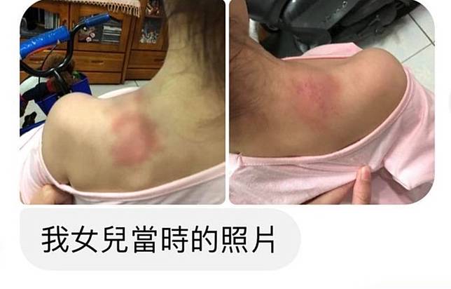 台南驚爆「累犯」托育員　再犯不當照顧傷男嬰