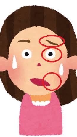 🥴顔面神経麻痺🥴を考える